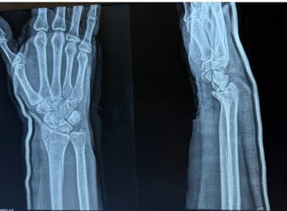 Dr. Tarun Bali - Best Orthopedic Doctor in Bangalore business photograph