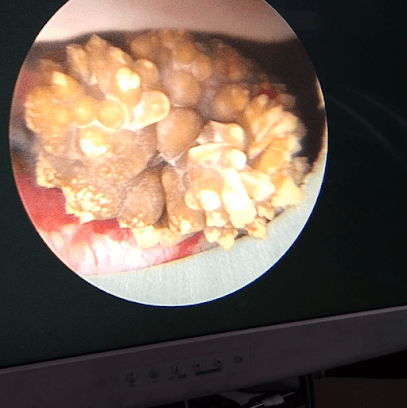 Dr Ajinkya Patil, Urologist CUROLOGY Kidney Stone, Prostate & Laser Center business photograph