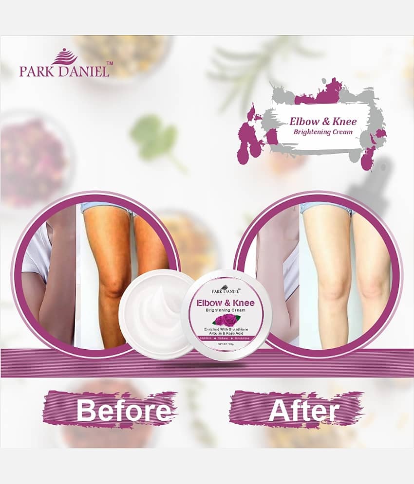 Park Daniel Elbow and Knee Skin Whitening Cream to Remove Dark Spots Pack of 1 of 100 Grams