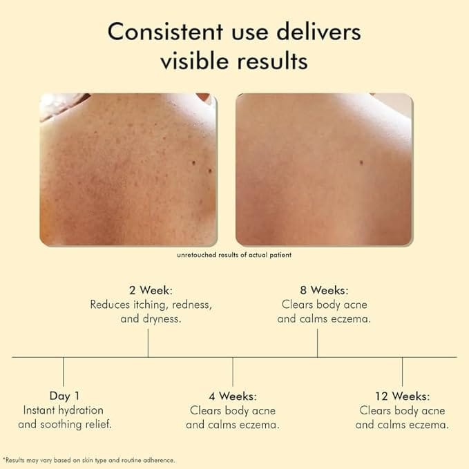 VEDICDERM Goat Milk Body Wash for Dry & Sensitive Skin | Natural Moisturizing Formula with Goat Milk, Aloe Vera & Shea Butter | Gentle Cleansing, Hydration & Nourishment | 200ml (Pack of 1) view 2