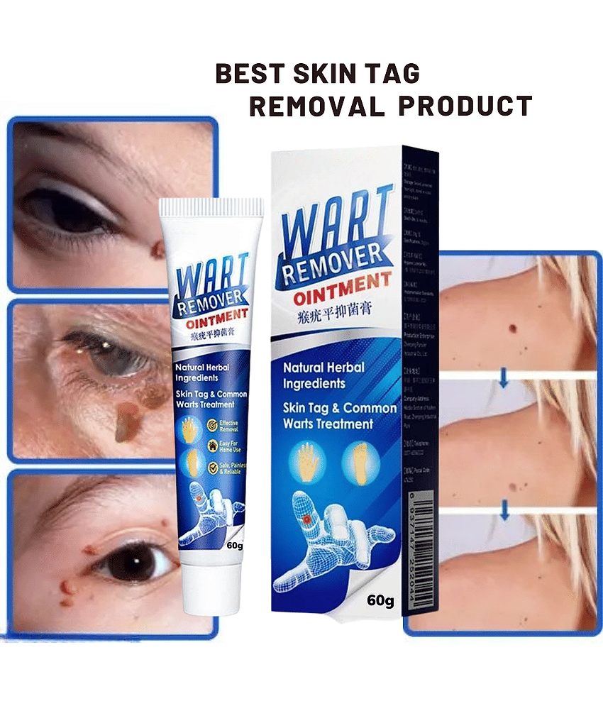 Massa Cream for Remove Warts Blackhead Remover