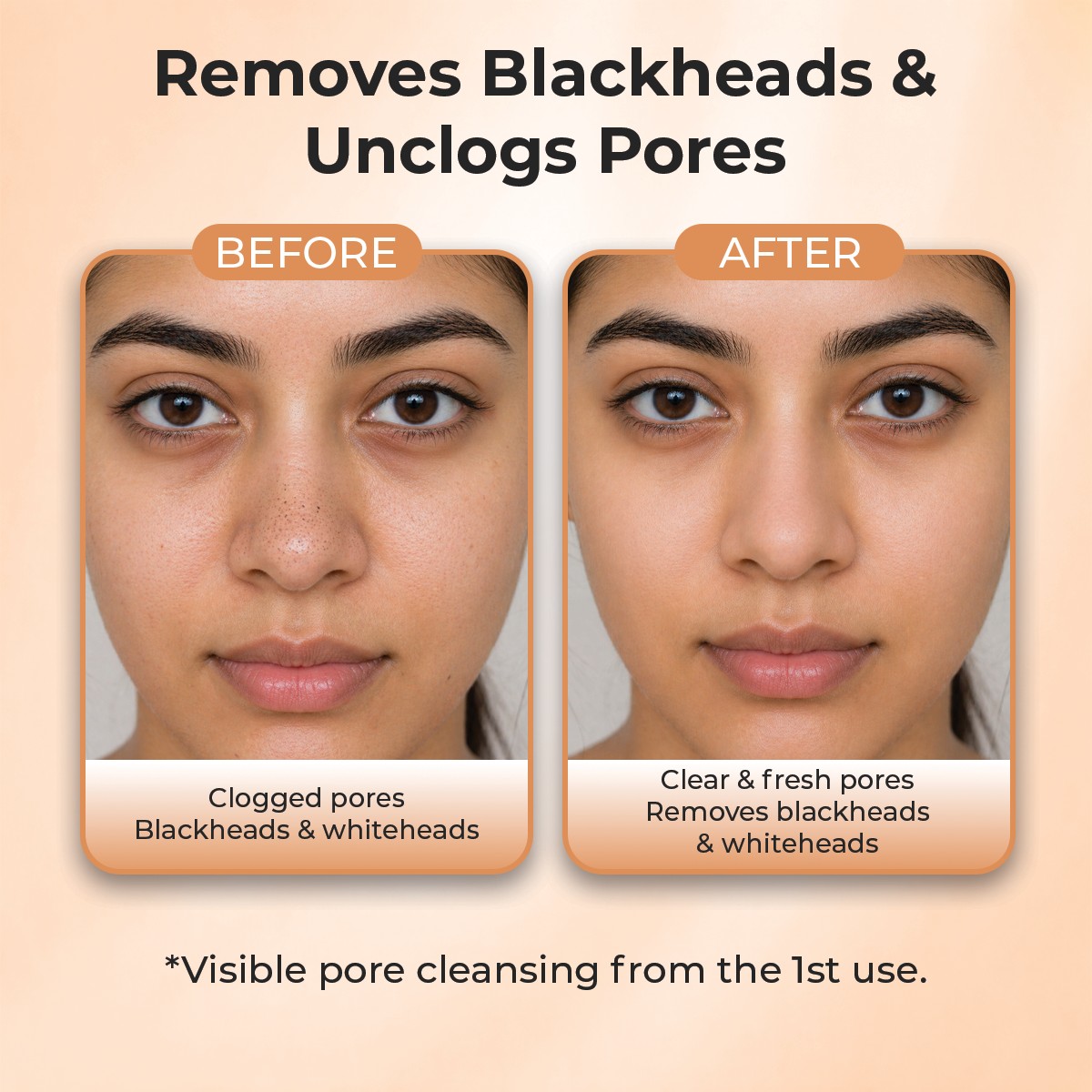 Sanfe Deep Purifying Nose Strips - Pack of 3