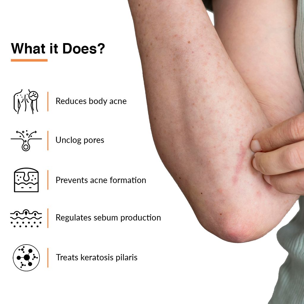 Fixderma Salyzap Spray for Body Acne view 2