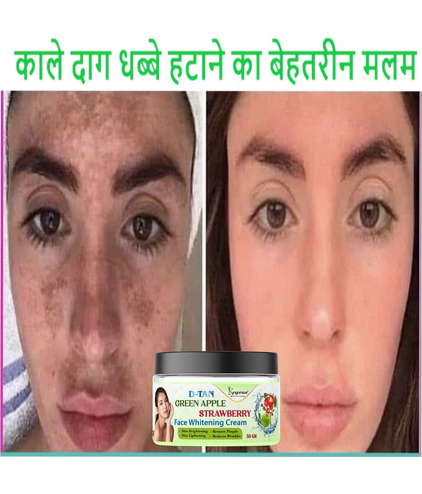 Keyoza Moisturizer All Skin Type Aloe Vera ( 50 gm )