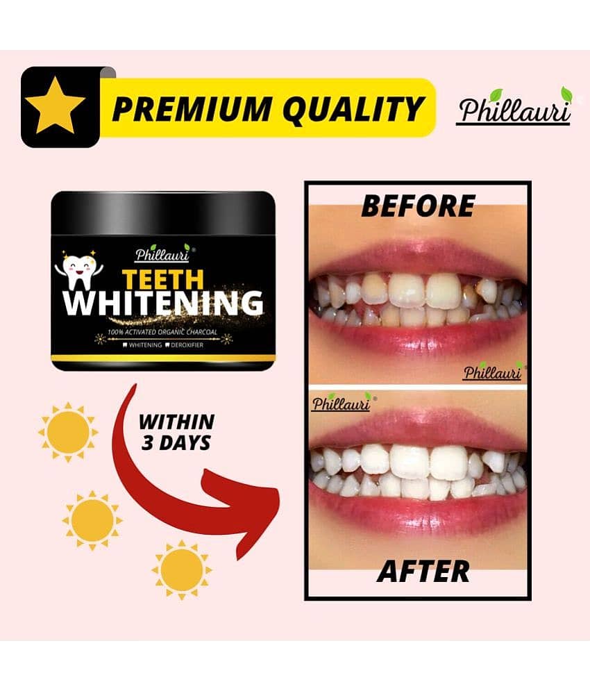 Phillauri Teeth Whitening Kit 60 view 2