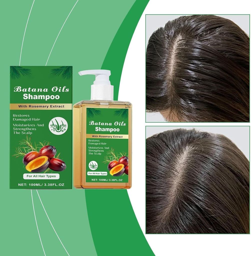 ELHAE Batana Oils Shampoo With Rosemary Extract | For All Hair Types | Nourishing Cleanser That Helps Moisturize & Strengthen Scalp and Hair | Gentle Use Daily Shampoo (200ml) view 2