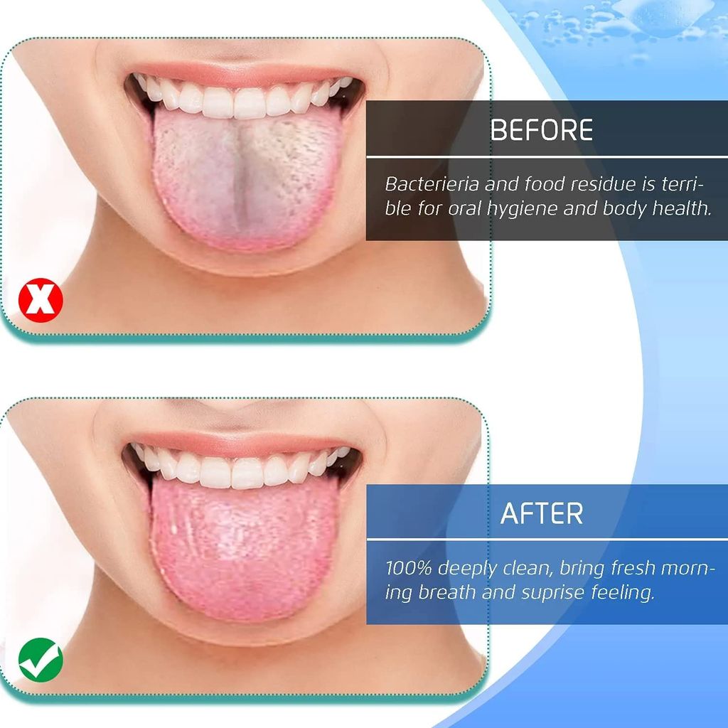 Elecsera Oral Tongue Cleaner Brush Scraper, 2 pcs(color & design may vary) view 2