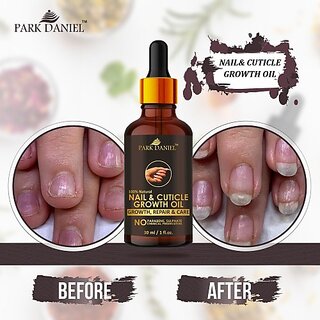 PARK DANIEL Premium Nail & Cuticle Growth Oil- For Nail Growth, Repair & Cuticle Care(30 ml) Yellow () view 2