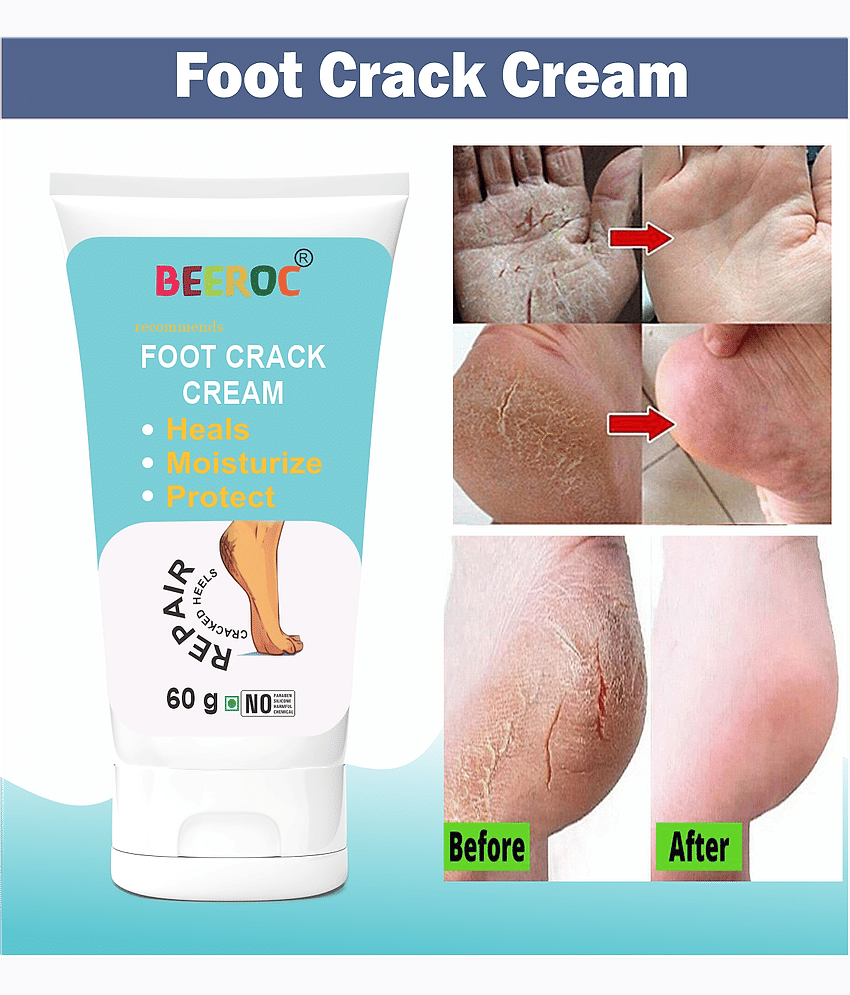 BEEROC Cracked skin repair Cream for All year ( 60 g )