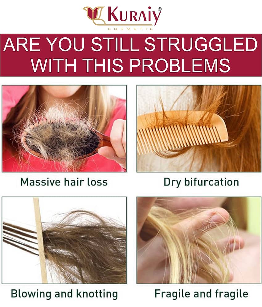 KURAIY RED ONION CONDITIONER FOR HAIR GROWTH & REDUCE HAIR FALL 200ML view 2