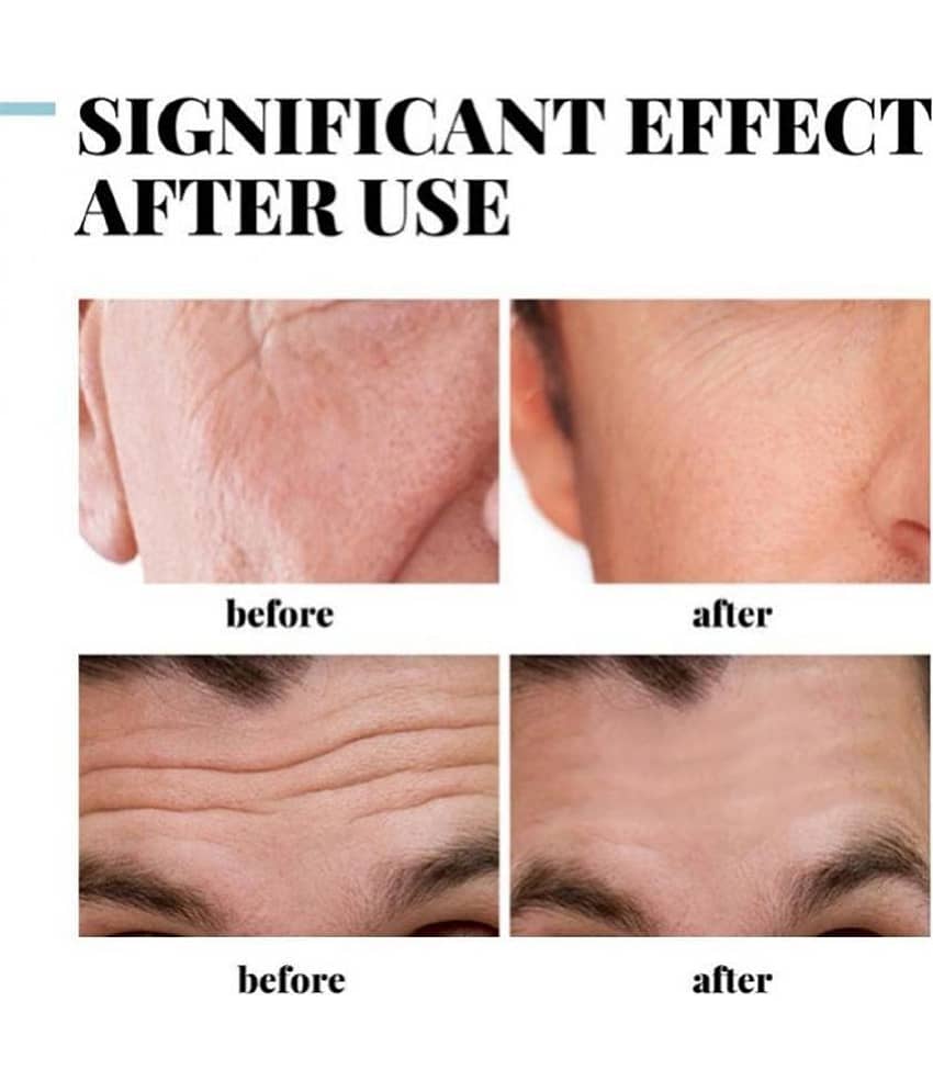 KURAIY Anti Aging Facial Cream Anti Aging Facial Cream Pack Of1 50gm view 2