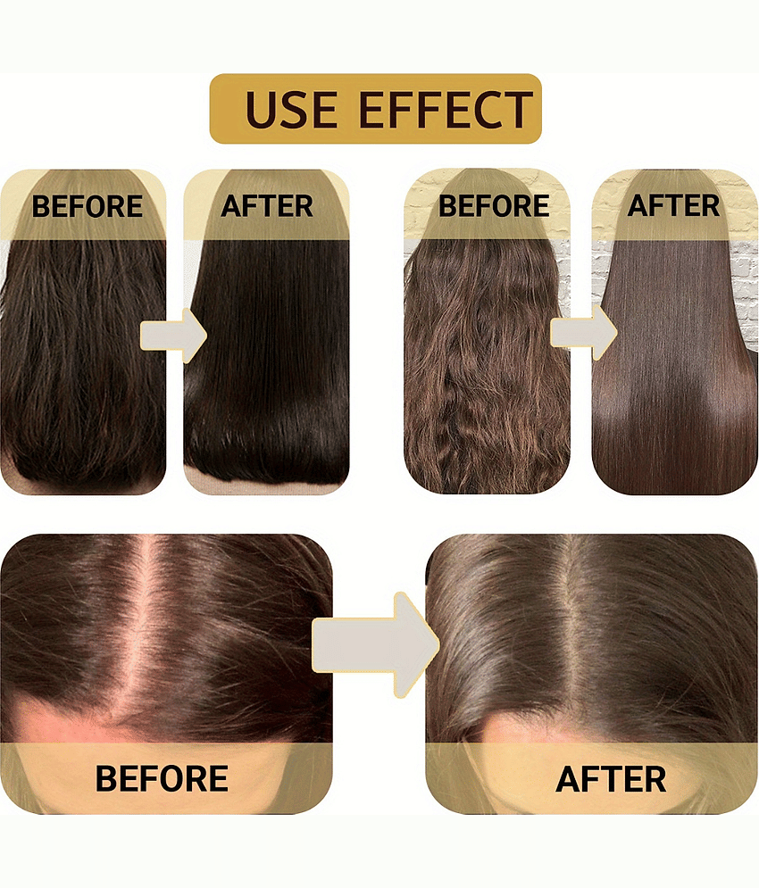 Hair Repair Anti Dandruff Hair Mask And Shapmoo | Hair Care Combo Use For Men And Women view 2