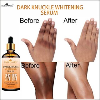 PARK DANIEL Whitening Serum For Removing Dark Knuckles Elbow & Knee Men & Women (30 ml) view 2