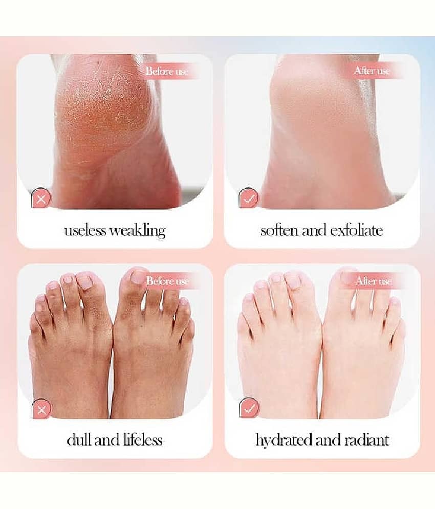 GOVAGGY - Cleansing Peel Off Mask For All Skin Type ( Pack of 1 ) view 2