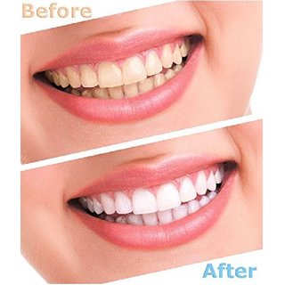 Luma Smile Tooth Polisher Whitener Stain Remover with LED Light view 2