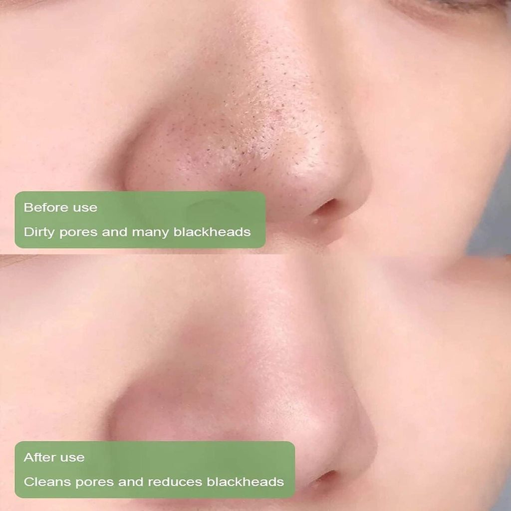 Green Tea Stick Mask - Natural Deep Cleansing Oil Control Acne Treatment Blackhead Remover Face Mask - Solid Mask Stick for Women and Men view 2