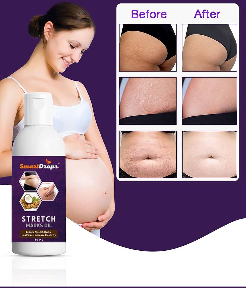 Smartdrops Smartdrops Stretch Mark Remover Shaping & Firming Oil 60 mL - Pack of 2 view 2