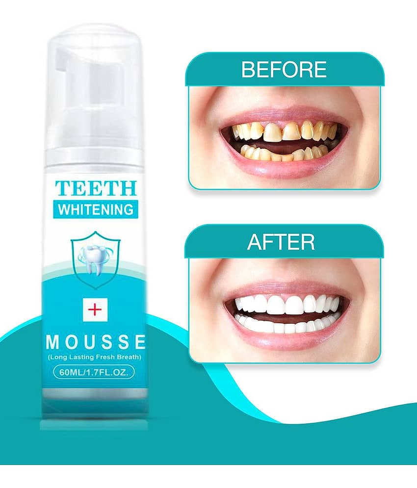 REGOLITH DEEP CLEANSER TEETH WHITENING FOAM Standard Oral Kit