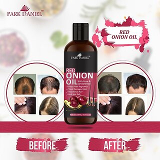 PARK DANIEL Premium Brown Rice Hair Oil Enriched With Vitamin E - For Strength and Hair Growth(100 ml) Hair Oil (100 ml) view 2