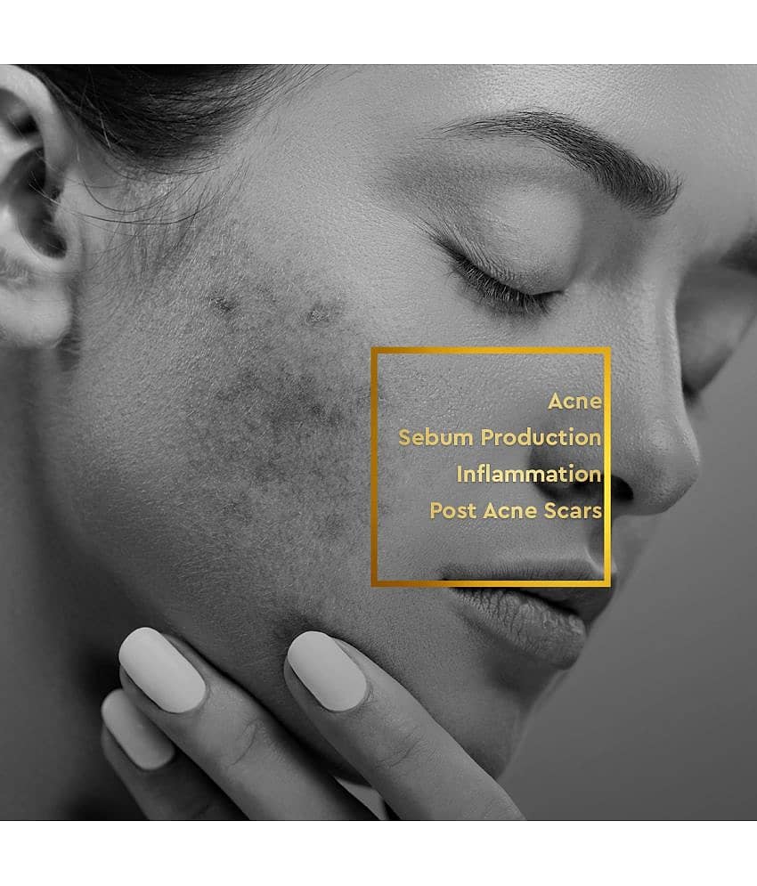 VLCC Clinic Acne Purifying Regime (Anti Acne Face Wash - 150 ml, ProRescue Micro Serum - 30 ml & Bio Cream - 100 g) view 2
