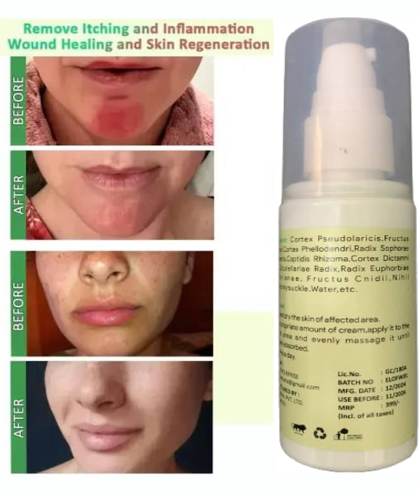 Elatiz Moisturizer All Skin Type Aloe Vera ( 50 gm ) view 2