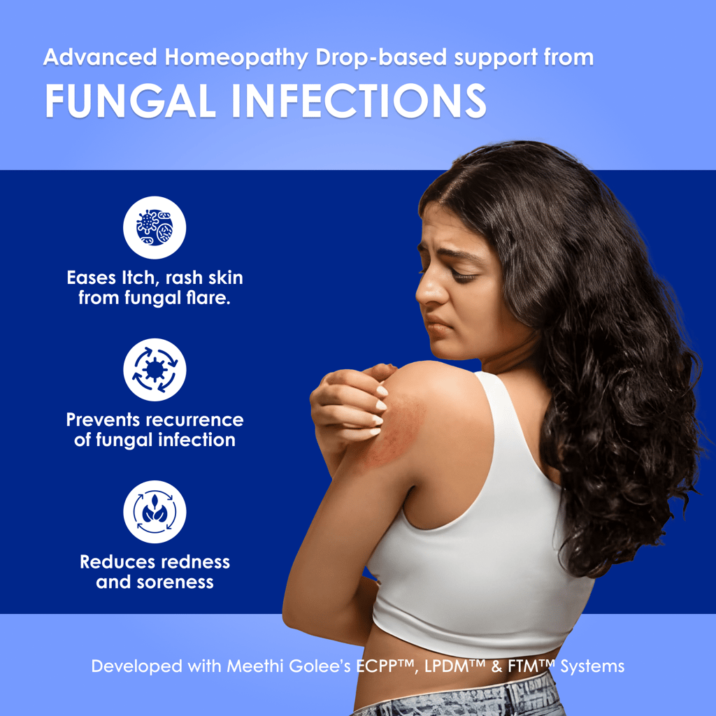 Meethi Golee Fungal Clear Drops for Skin Comfort Support (30ml) | Advanced Homeopathy 2.0 Skin & Immune Balance Formula for Itching, Redness & Recurrent Fungal Sensitivity | Fast Absorbing Oral Drops view 2