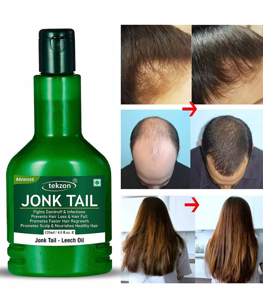TEKZON Jonk Oil Leech Tail for Hair Growth hair growth 120 mL view 2
