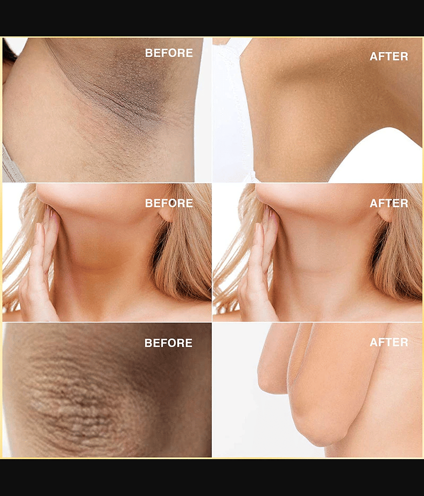KURAIY Underarm Whitening Cream for Dark Underarms Spot Removal view 2