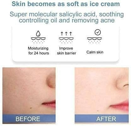 Elecsera Ice Cream Mask Acne Moisturizing Smear Mask Blackheads Remover Mask Cleansing & Shrinking Pores with Bleach Brush (2 Items in the set) view 2