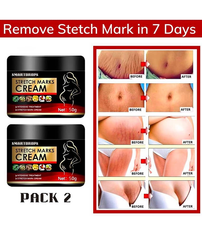 Smartdrops Pragnancy Stretch Mark Remove Cream Shaping & Firming Cream 50 g - Pack of 2 view 2