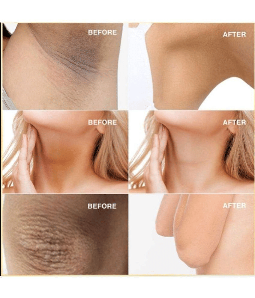 KURAIY Advanced Under-Arm Whitening Cream Pack Of 1 view 2