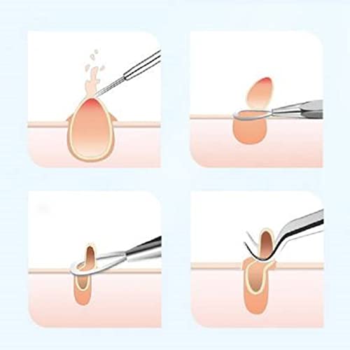 Elecsera 4Pcs Blackhead Pimple Golden Remover Tools for Face Professional Extractor Tweezers Kit for Remove Acne Pimple Comedown Extractor, Black Heads Removing on Face Removal (Pack of 4) view 2