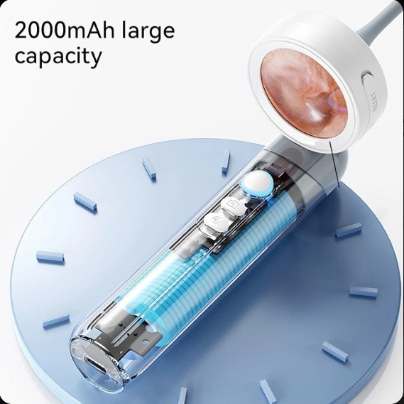 Digital Video Otoscope with USB for PC View and Own screen Play
