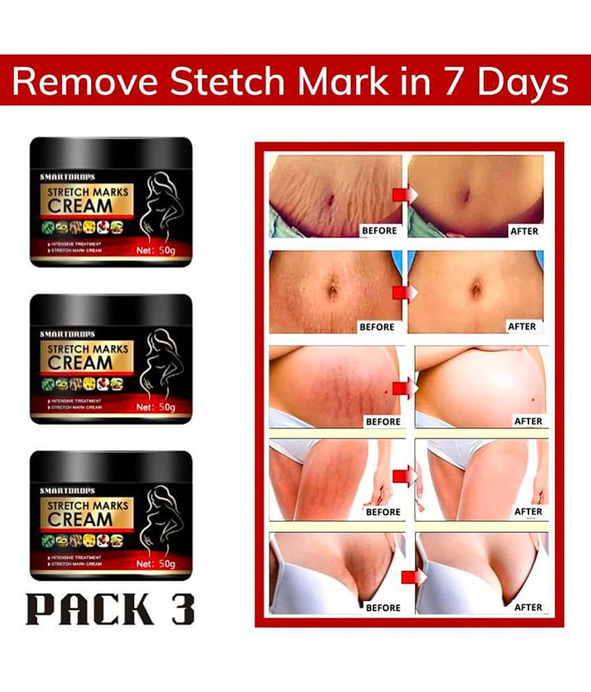 Smartdrops Pragnancy Stretch Mark Remove Cream Shaping & Firming Cream 50 g - Pack of 3 view 2