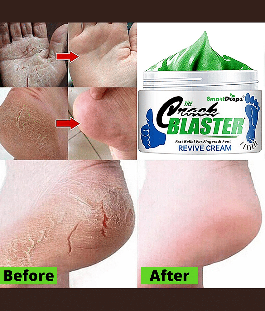 Smartdrops Smartdrops Foot Cream SPF 24 ( 150 g ) view 2