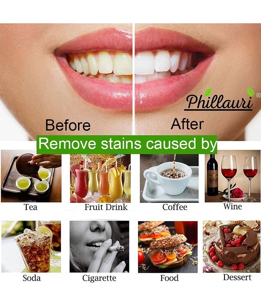 Phillauri Phillauri Teeth Whitening Denture Oral Kit view 2
