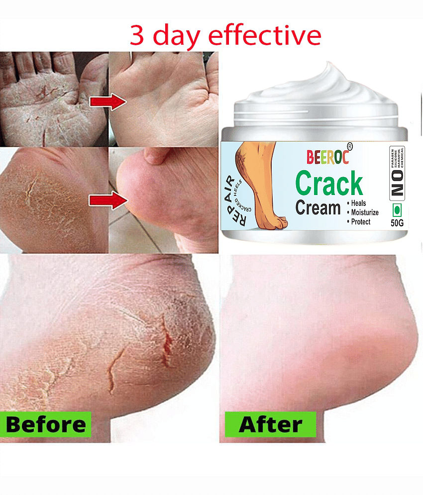 BEEROC Cracked skin repair Cream for ( 50 g )