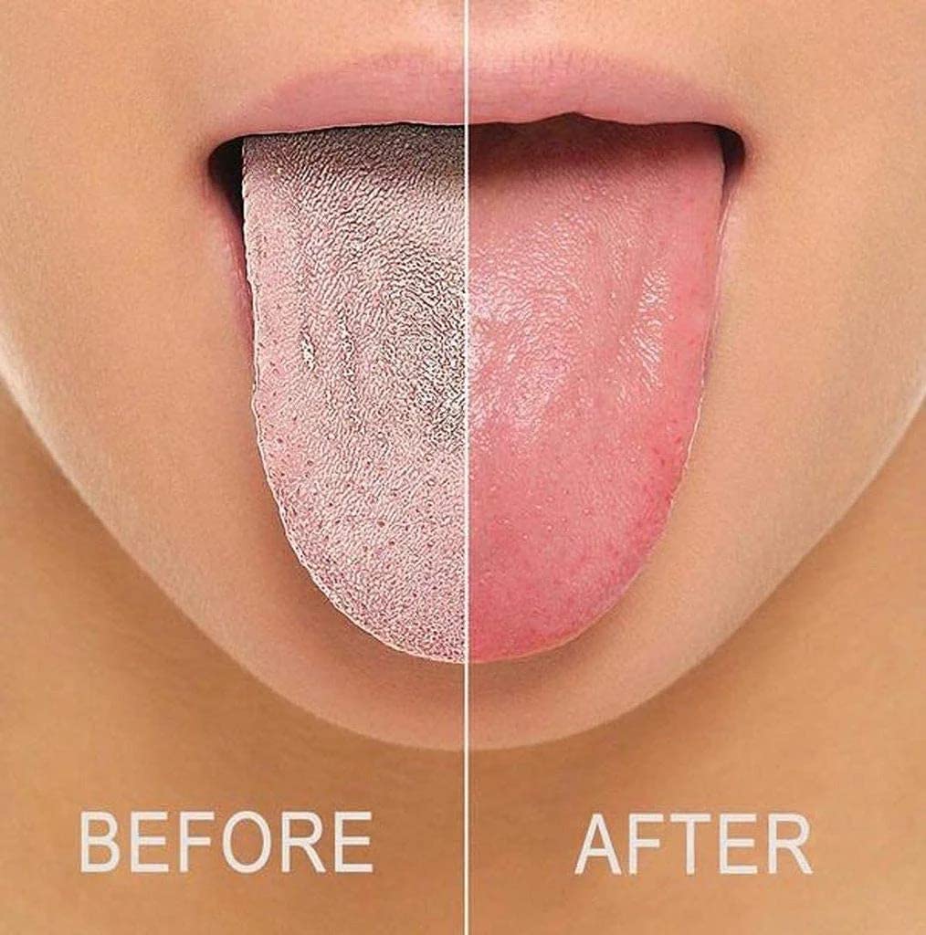 Elecsera Soft Double Action Tongue Cleaner Scrapper For Kids and Adults With Travel Capsule Plastic Tooth brush paste holder flexible design for health, Oral care tool Easy To use 5pcs view 2