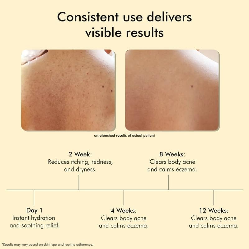VEDICDERM Goat Milk Body Wash for Dry & Sensitive Skin | Natural Moisturizing Formula with Goat Milk, Aloe Vera & Shea Butter | Gentle Cleansing, Hydration & Nourishment view 2