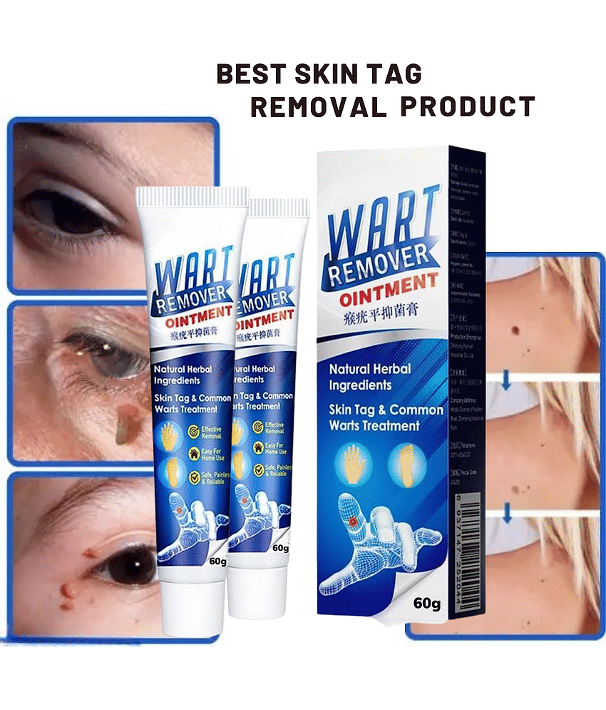 Massa Cream for Remove Warts Blackhead Remover
