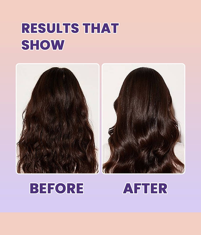 ALGLAZE Hair Growth Rosemary Oil 100 ml ( Pack of 1 ) view 2