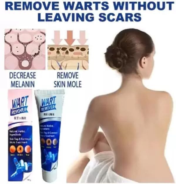 Elecsera WARTS REMOVER CREAM FOR MEN AND WOMEN PACK OF 1 (100 g) view 2