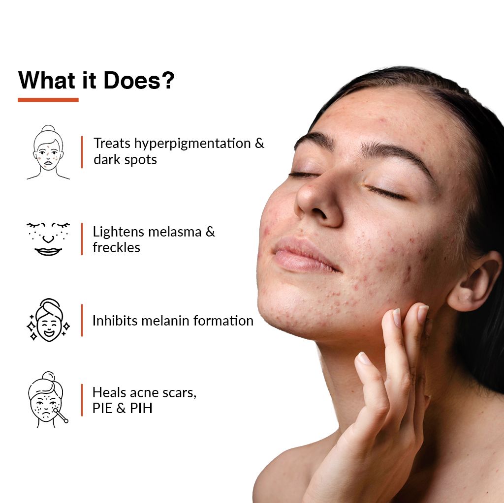 Fixderma Skarfix-TX view 2