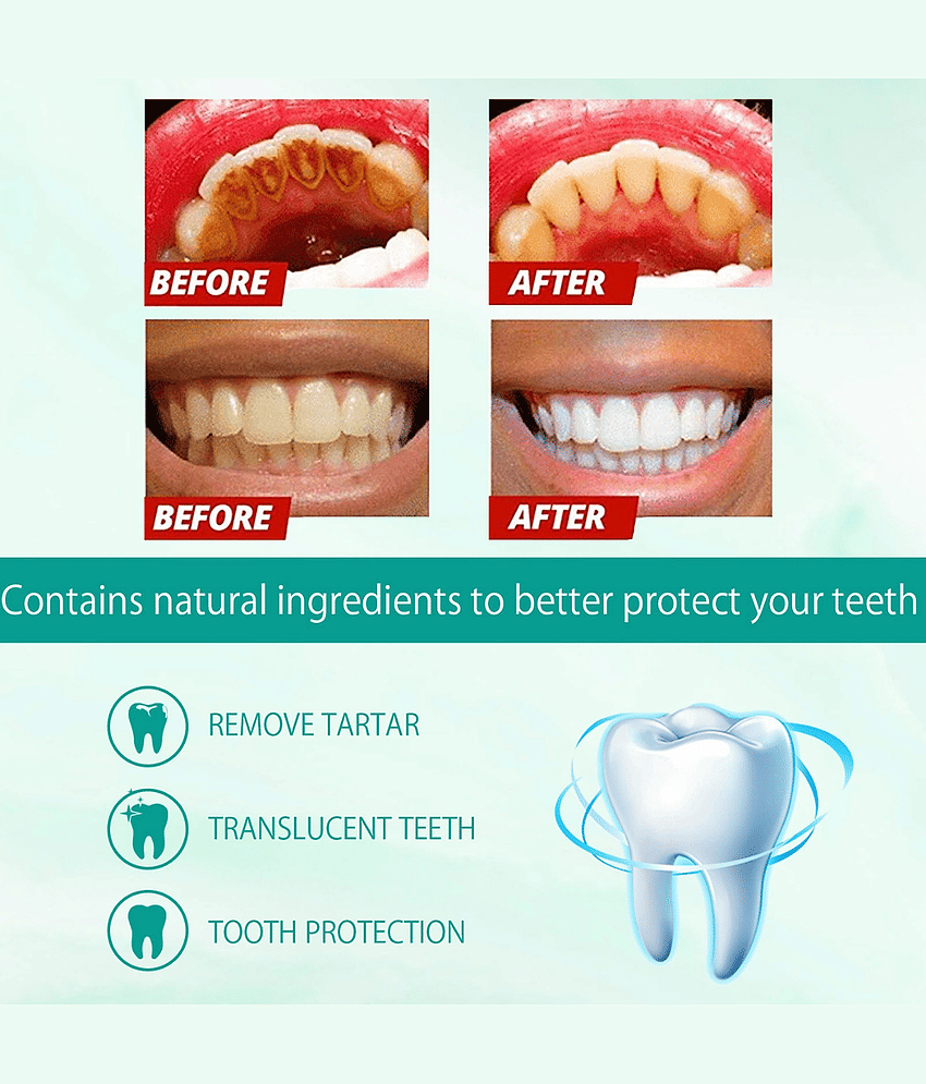 Phillauri Teeth Whitening Denture Oral Kit view 2
