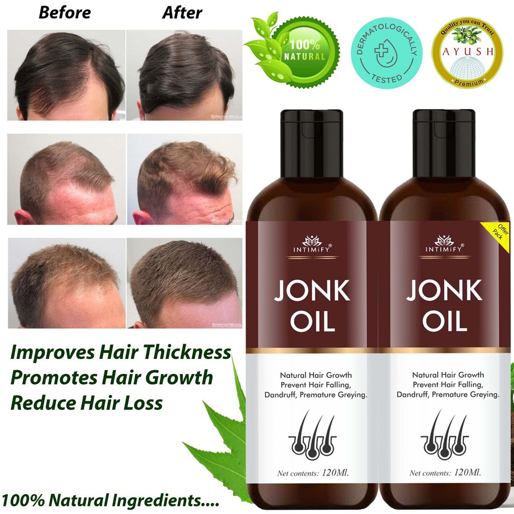 Intimify Jonk Hair Oil, hair growth oil, jonk oil, hair regrowth oil, anti haifall oil, promotes hair growth 120 ml view 2