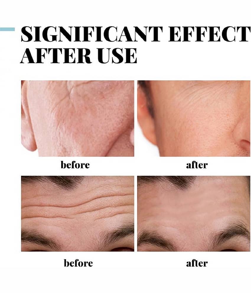 KURAIY Anti Aging Facial Cream Anti Aging Facial Cream Pack Of1 50gm view 2