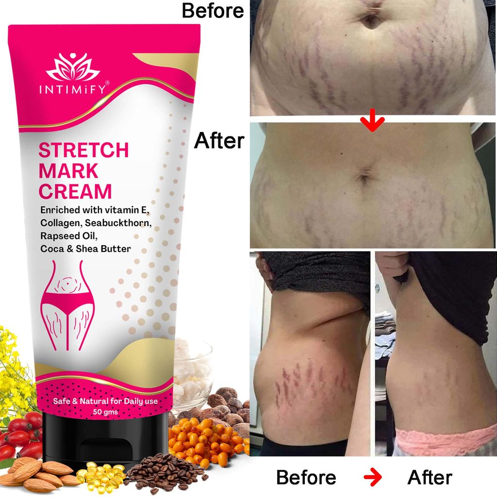 Intimify Stretch Mark Cream, Stretch Mark Remover, Scar Cream, Firming Cream 50 g view 2