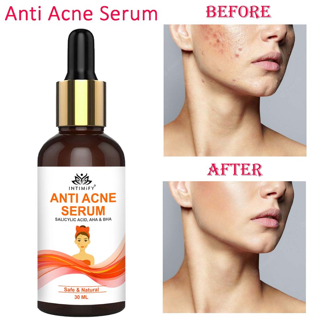 Intimify anti acne serum, anti aging wrinkles serum, face serum, skin brightening serum, anti wrinkle face serum (30 ml) view 2