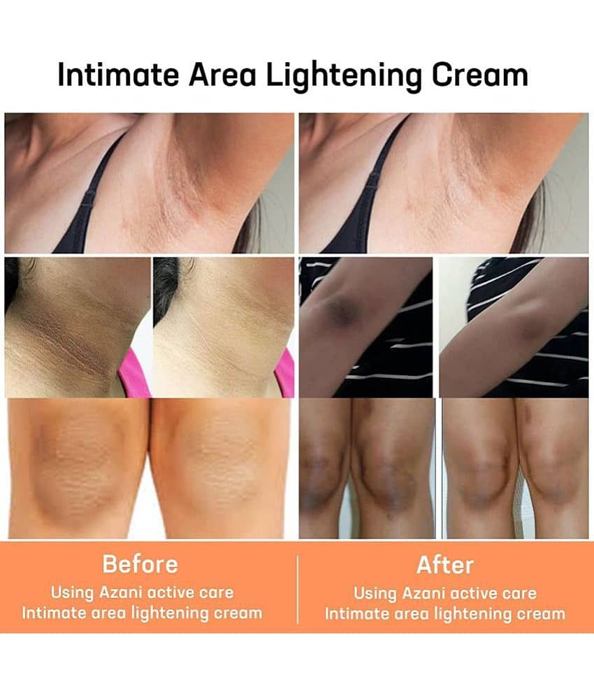 Smartdrops Underam Whitening Skin Brightning Cream Hand Cream 50 g - Pack of 3 view 2