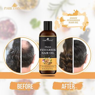 PARK DANIEL Premium Virgin Coconut Oil(200 ml) Hair Oil (200 ml) view 2